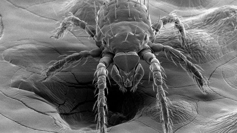 Chigger Scanning Electron Microscopy - Scrub Typhus Bacteria Detected In NC Chiggers: A Public Health Concern