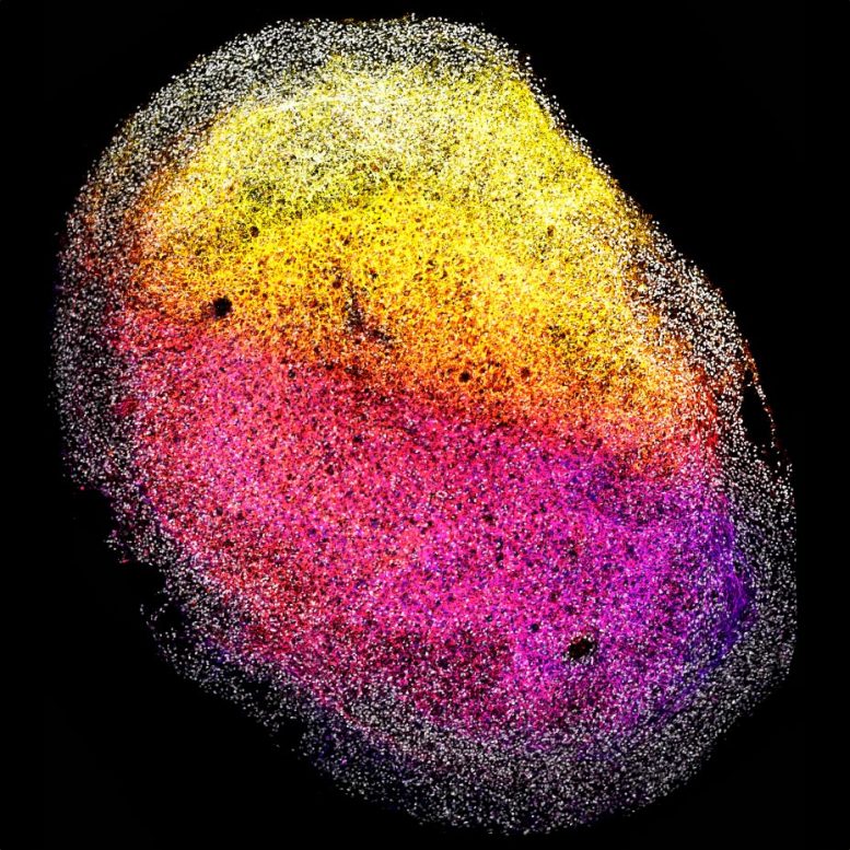 Whole Human Fetal Brain Organoid - Not Sci-Fi: Scientists Develop Brain Organoids From Fetal Tissue To Revolutionize Neurological Research