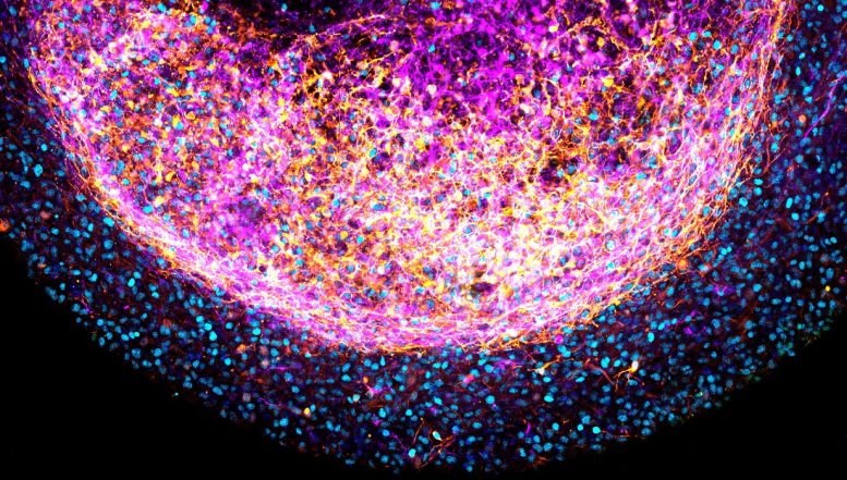 Human Fetal Brain Organoid Close Up - Not Sci-Fi: Scientists Develop Brain Organoids From Fetal Tissue To Revolutionize Neurological Research