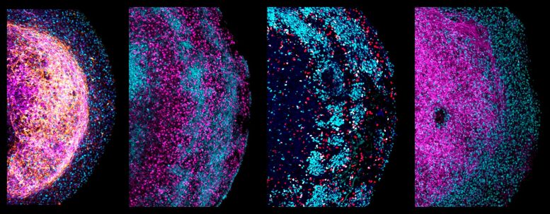 Different Human Fetal Brain Organoids - Not Sci-Fi: Scientists Develop Brain Organoids From Fetal Tissue To Revolutionize Neurological Research