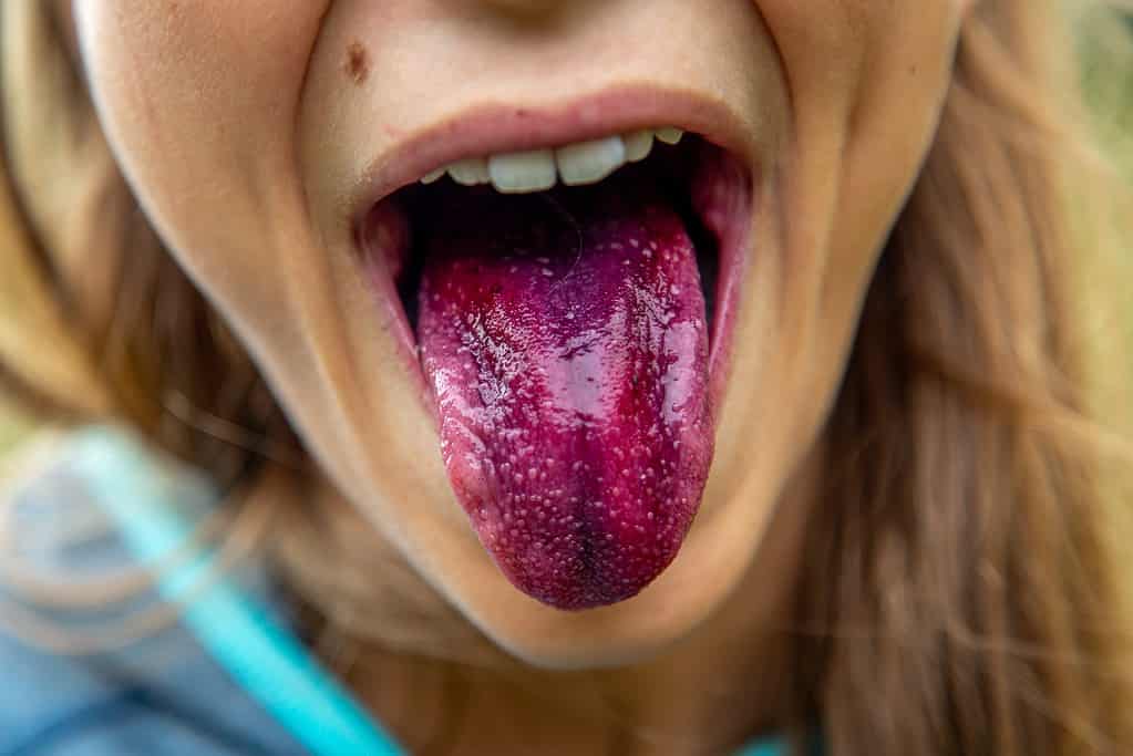 Artificial Intelligence Algorithm Shows Our Tongues Really Are Unique