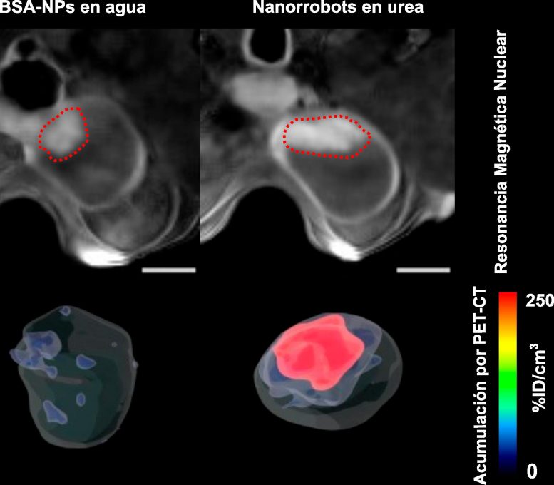 Accumulation of Nanorobots in Bladder Tumor - Fantastic Voyage: Cancer Tumors Reduced By 90% Using Nanorobots