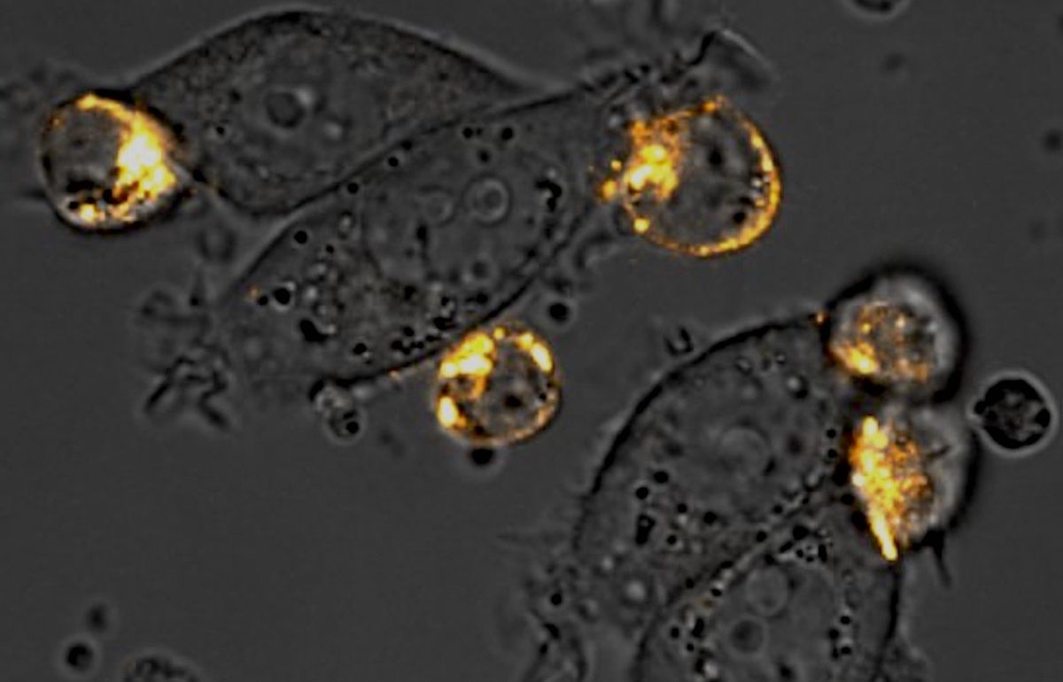 Microscopy image showing orange circles attached to grey, oblong cells. - Bugs As Drugs To Boost Cancer Therapy