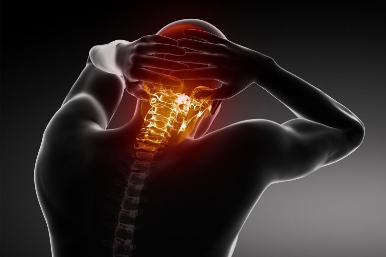 Migraine Headache Neck Pain - Neck Inflammation: The Hidden Culprit Behind Common Headaches