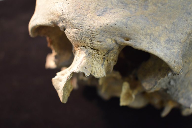 Part of the Face of Project Number 766 - Reconstructing History: “Bone Biographies” Reveal Medieval Life Secrets