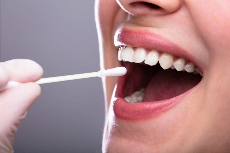 Saliva Test Dentist - In The Near Future, A Little Saliva May Be Enough To Detect Cancer