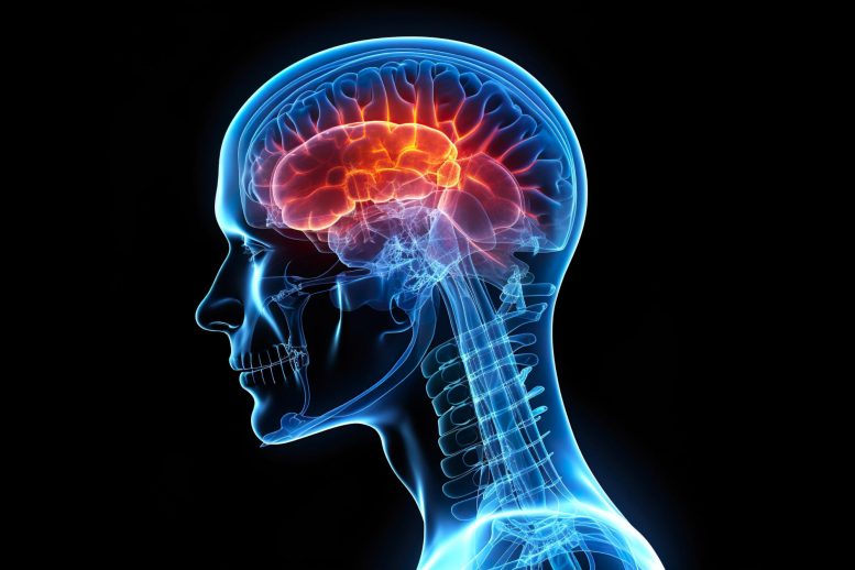 Traumatic Brain Injury X Ray - The Hidden Consequences Of Brain Trauma: Study Uncovers New Insights