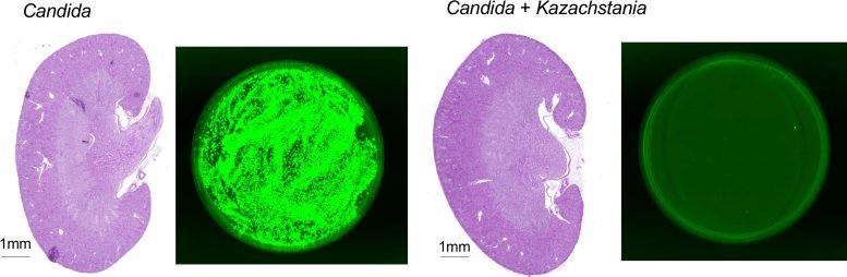 K. weizmannii Mitigates Invasive Candidiasis in Immunosuppressed Mice Graphic - Newly Identified Yeast Could Prevent Fungal Infections