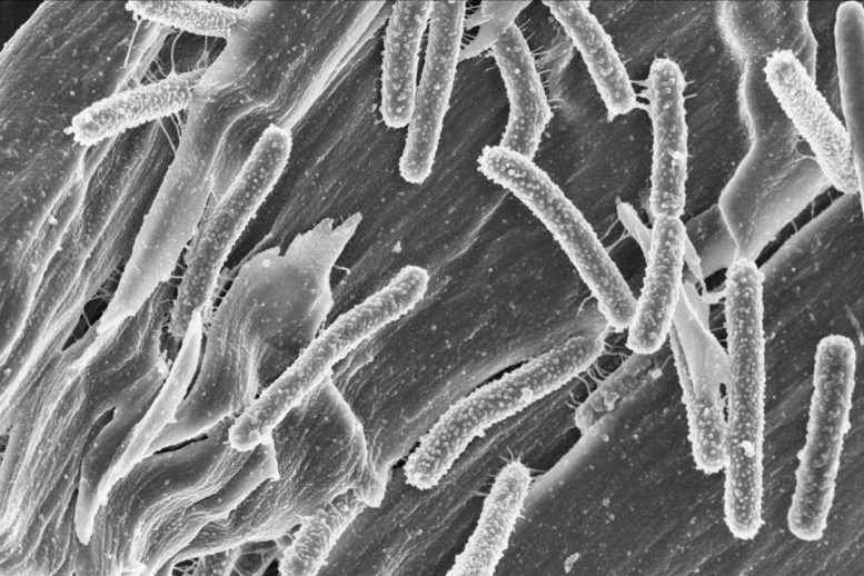 Clostridium clariflavum - Modern Living Is Stripping Our Gut Of Healthy Bacteria