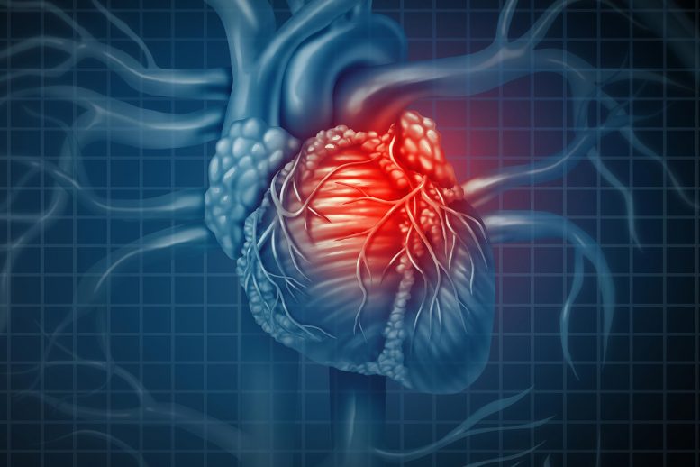 Heart Disease Concept - New Potential Biomarkers Of Coronary Heart Disease Discovered
