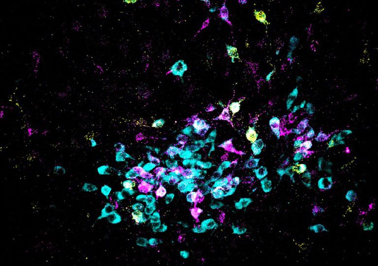 Neurons Shown in Cyan and Retrograde Tracers Shown in Yellow and Magenta - Neurobiologists Have Discovered How Stress Turns Into Fear – And A Method To Block It
