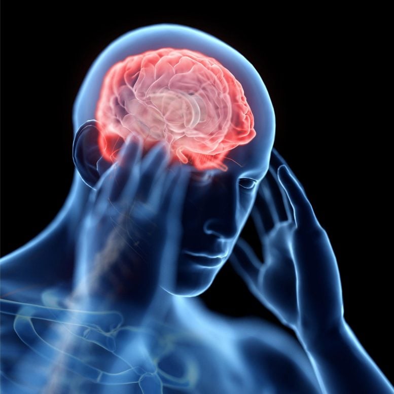 Man Headache Anatomy Science Image - Teenage E-Cigarette Use Linked To Frequent Headaches