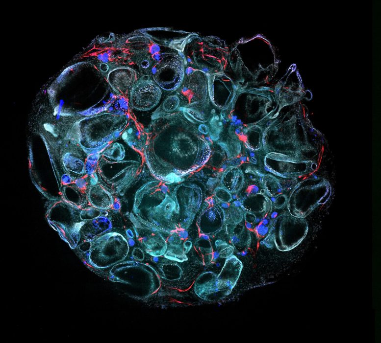 Polycystic Kidney Disease Organoid - Mini Kidneys Uncover Big Advances In Polycystic Kidney Disease Research