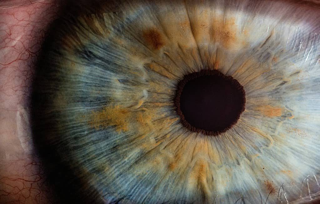 Eye Implants May Soon Be Used To Treat Diabetes