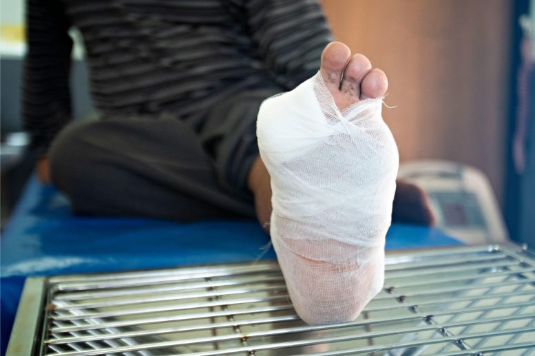 Diabetic Foot Wound - Stem Cell Magic: Scientists Unveil New Superhero For Healing Diabetes Wounds