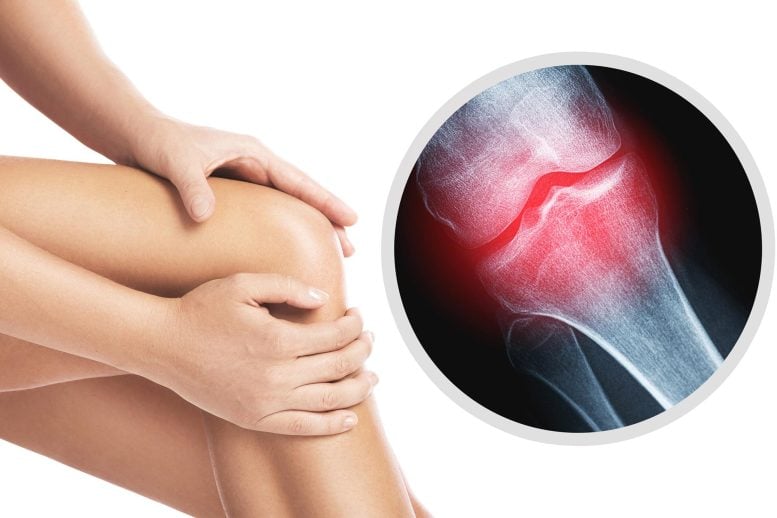 Knee Pain Injured Joint - Blood Test Detects Knee Osteoarthritis 8 Years Before X-Rays