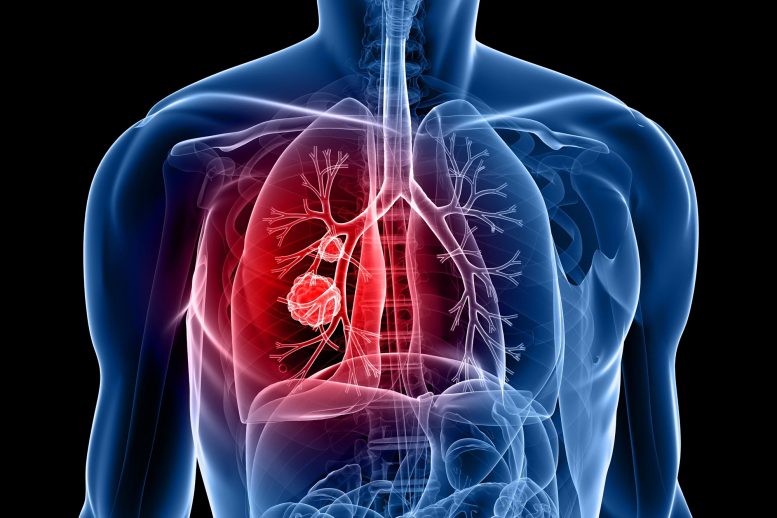 Nanoengineered Plant Virus Could Protect and Save Your Lungs From Metastatic Cancer