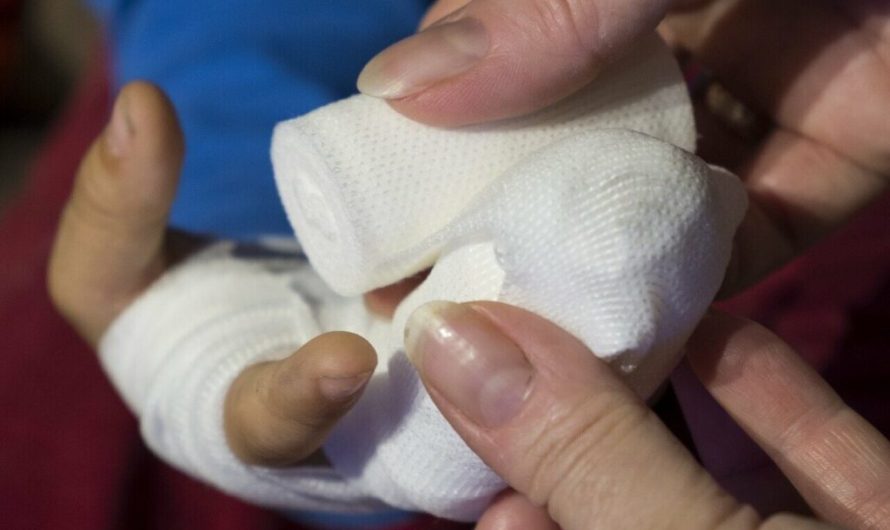 New smart bandages could change the way we treat wounds