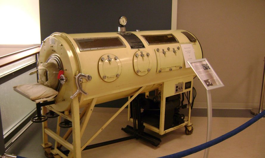 What are ‘iron lungs’, and could this old tech still be useful today?