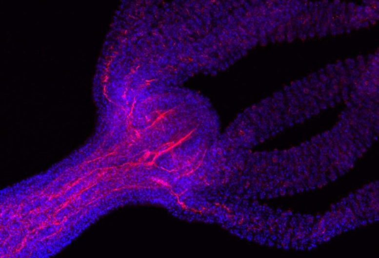How Hydra – A Group of Small Aquatic Animals – Regenerate Their Own Heads