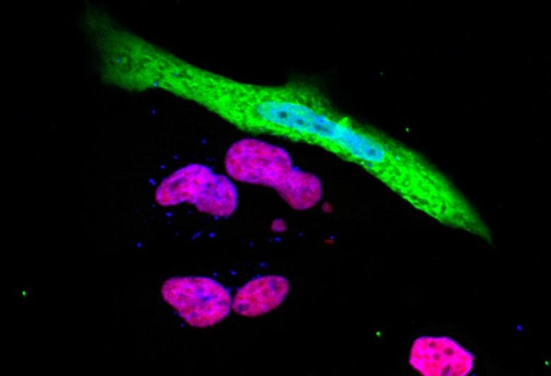 COVID-19 Breakthrough: Scientists Discover How the SARS-CoV-2 Virus Evades Our Immune System