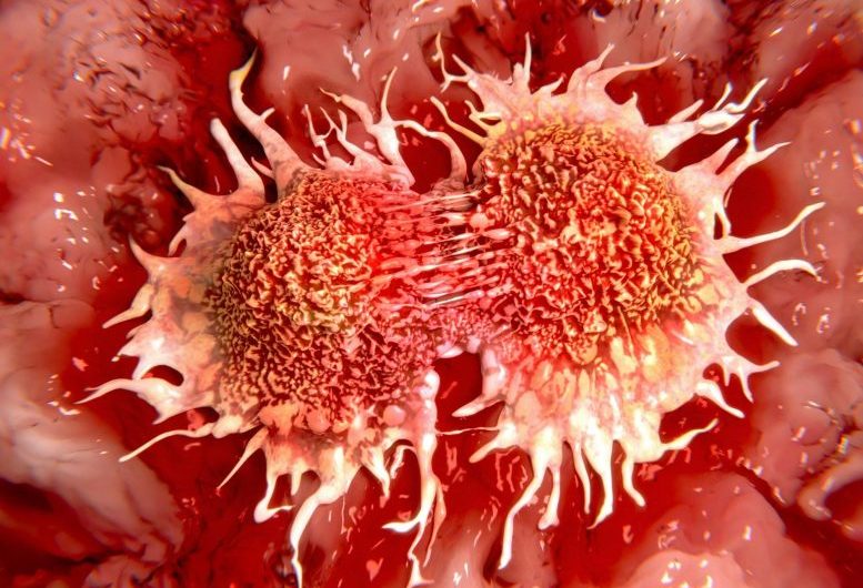 Gene Involved in Sense of Smell Could Play Role in Spread of Breast Cancer to the Brain