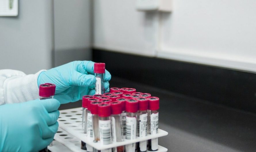 A novel blood test can detect the presence of cancer, and whether it’s metastasized